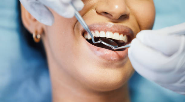 Best Emergency Dental Extractions in Waverly, VA