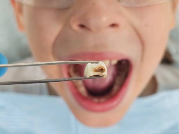 Best Pediatric Emergency Dentist in Waverly, VA