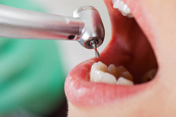 Best Emergency Dental Services for Seniors in Waverly, VA